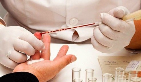 Все, что нужно знать о клиническом анализе крови