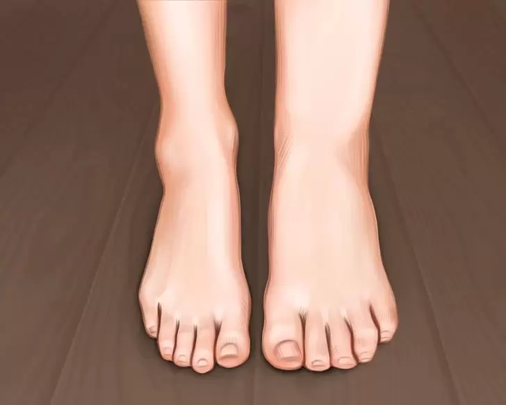 Почему отеки после 50 могут быть связаны с привычными продуктами