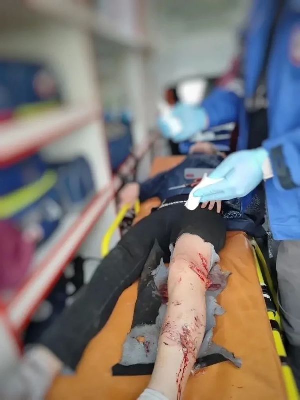 Прокуратура организовала проверку в связи с нападением стаи бродячих собак на двоих детей в районе мемориалов горы Шмидта в Норильске